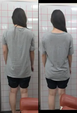 【予約受付中】12/8〜【ミニモ限定】オーダーメイド施術！（全身整体×肩甲骨はがし×反り腰矯正×ストレートネック）