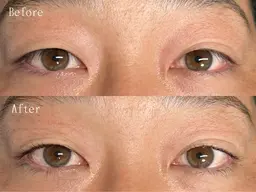 \逆まつげ解消‼️/メンズまつ毛パーマ【 視界良好👀✨ 】