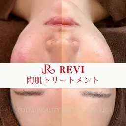 初回お試し♪【剥けないハーブピーリング】がさつき・肌荒れ・美白・毛穴改善