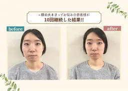 ≪グーグル口コミ投稿お約束価格≫ 小顔矯正と骨盤矯正60分 7600円→0円