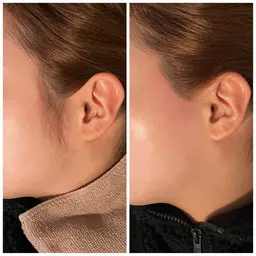 口コミ🈹Wax⭐︎2箇所選べるパーツ脱毛(おでこ、頬、鼻周り、口周り、もみあげ、)💫補足必読❣️メンズ🉑