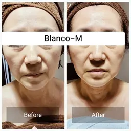 New✨完全リフトアップフェイシャルコース+全身アロマトリートメントの120分コースです🧖🏻💆🏻🦵🏻🙌🏻