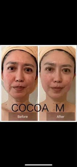 たるみへ圧倒的な結果⚠️お顔の筋肉のマッサージで−５歳へ。たるみ•ムクミ劇的改善•背中デコルテ首元＋顔筋マッサージ80分