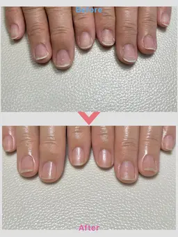 【バンド】ケアのみ　お爪の長さ、形を整えて→お湯で甘皮を柔らかくして→甘皮処理→仕上げはオイルで保湿🫧『自爪の方限定』