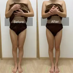 痩身エステ〔半身コース〕