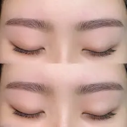 アイブロウ脱毛