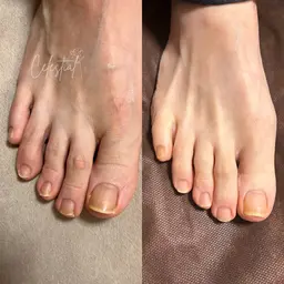 🫧つるんふわっ🩰フットケア⌇爪周り角質ケア+整爪+甘皮ケア⌇お肌に優しい弱酸性SpaLuce使用🧴