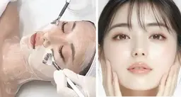 ララピール進化版💎 剥離なしで透明感UP✨ 敏感肌OK◎肌質改善韓国式ダクトピール＋幹細胞入れ込でツヤ美肌再生ケア🫧