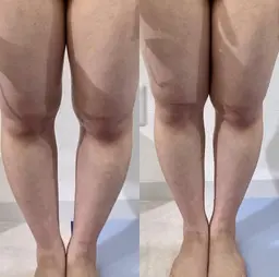 新規女性限定🍀オイルリンパマッサージ/フェイシャル/むくみ/痩身/ブライダル✨【全身骨格筋膜リリース＋小顔矯正】90分