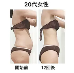 【ミニモ学割】新規様✨ウエストに腹筋を付けて引き締める電磁パルスマシン25分（腹筋約2.5万回分）¥3,000