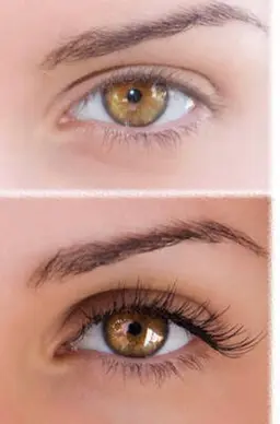 バインドロックつけ放題