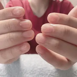 甘皮処理を行った後、トップコート(マニキュア)で仕上げ。