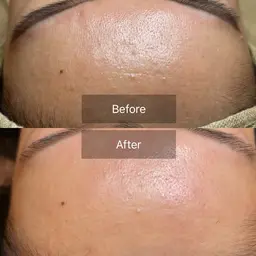 艶肌🍯🧖🏼♀️✨フェイシャルワックス脱毛😍✨ 化粧水の浸透力アップ⤴️⤴️⤴️