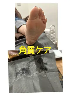 角質ケアとフットオフのセット