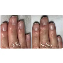 自爪育成(ジェルなし)単品