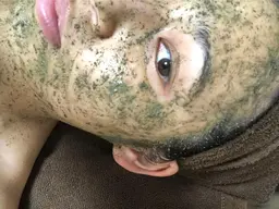 ハーブピーリング🌿スタンダードコース