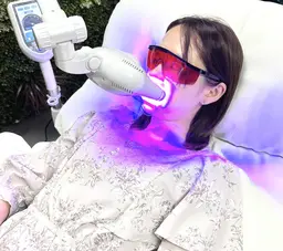 セルフホワイトニング30分