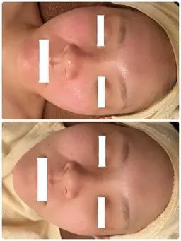 【小顔✖️美白🤍🫧】保湿小顔マッサージ💆🏼‍♀️水素パック🫧デコルテ，首ヘッドのマッサージ付き🌿