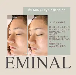 フェイシャルWax脱毛艶肌美容液仕上げ付き