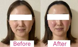 初回体験価格！モニタープラン①                              トライアングルフェイシャル®️