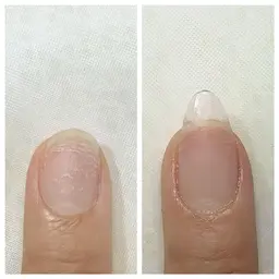 一級保持✨スカルプでの長さだし💅