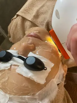 大人気メニュー✴︎リフトアップフォト☆リフトアップ・美白に！