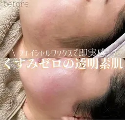 🫧フェイスワックス🫧高保湿パック付💖お問い合わせください😊