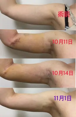 【平日限定】30分【上半身】術後ケア お一人様2回まで/2500円【顔不可】◆10分延長1700円