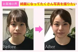 小顔矯正【たるみ改善・法令線・エラ・左右差】頭蓋骨から根本的に整える整体