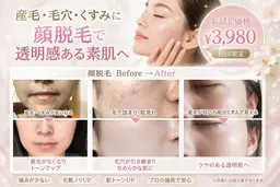 期間限定!顔脱毛