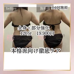 【1回で最大限のサイズダウン】全身徹底痩身➕部分強化120分1回25000円→初回19900円!