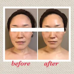 リピート率90%以上❣️効果🙆の頭蓋骨×3D小顔矯正♪ミニモ特別価格✨2回目以降もお得に受けて頂けます❣️