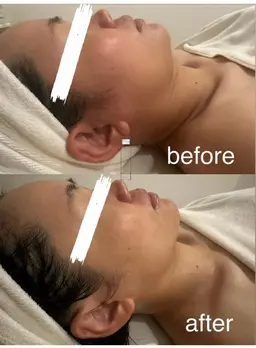 【ほぐし緩めお顔の黄金比を造る美人小顔造形】ヘッド背中デコルテリンパ付♪