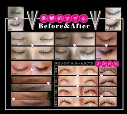 ❤︎超音波ソニック使用❤︎ラッシュアディクト×V3❤︎フェイシャルエステ(30分)💆‍♀️✨