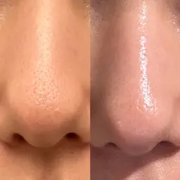 【他メニュー併用】ハイドラフェイシャル