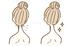 ⭐️ミニモ限定⭐️最新美肌脱毛 《うなじ》