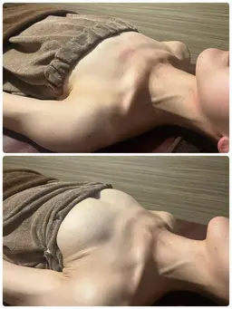 《新規》流れた脂肪を寄せあげ❤️‍🔥バストアップ×背中痩身✨光豊胸バストアップコース/施術30分