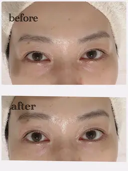 お顔の筋トレ🏋️EMSで浮腫み撃退！スッキリ顔にリフトアップ🧏🏻‍♀️💖