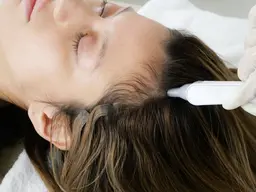 スカルプケア【ハイドラ頭皮洗浄】髪が濡れない◎  〈額上​〜​頭頂部まで〉15分