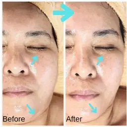 ふっくらハリ肌・オーダートリートメント