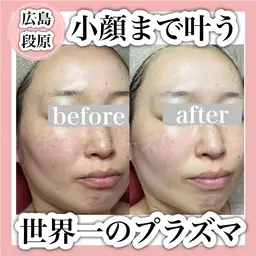 世界一のプラズマ