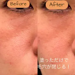 ファーマリジェネプレミアムインテンシブコース　25000円→12000円‼️