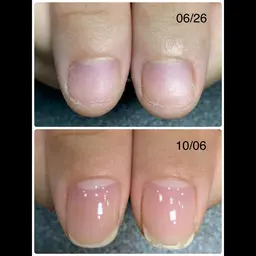 深爪軽度育成コース:ハンドジェルネイルワンカラー(施術時間90分)¥11,000