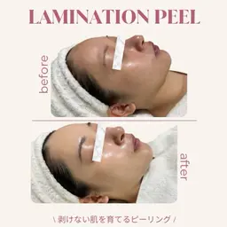 《ミニモ学割》U24  ラミピール×モデリングパック◇次世代ピーリング|剥離なし