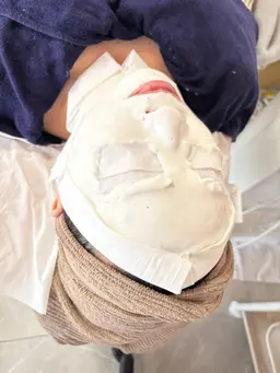 紫外線ダメージケアコース