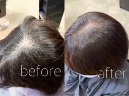 【ミニモ限定】白髪染め➕髪質改善トリートメント‼️