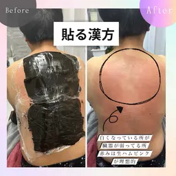 【※最低5回受けれる方※】よもぎ蒸しを超える！！“貼るタイプ”ハーブ温熱パック🌿(2部位)足裏マッサージ付き50分