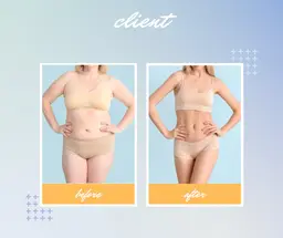 🔥すぐに痩せたい人🔥セルライト消し！上or下半身選べる！キャビテーション痩身マシン【切らない脂肪吸引マシン】