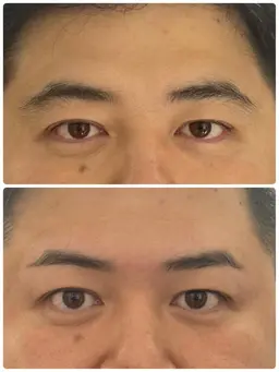 メンズのご新規様限定❗️デザインワックス眉脱毛🤏