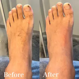 【男性】1部位（小パーツ）・眉毛だけ・指（手or足）・甲（手or足） ・乳首周り・鼻毛